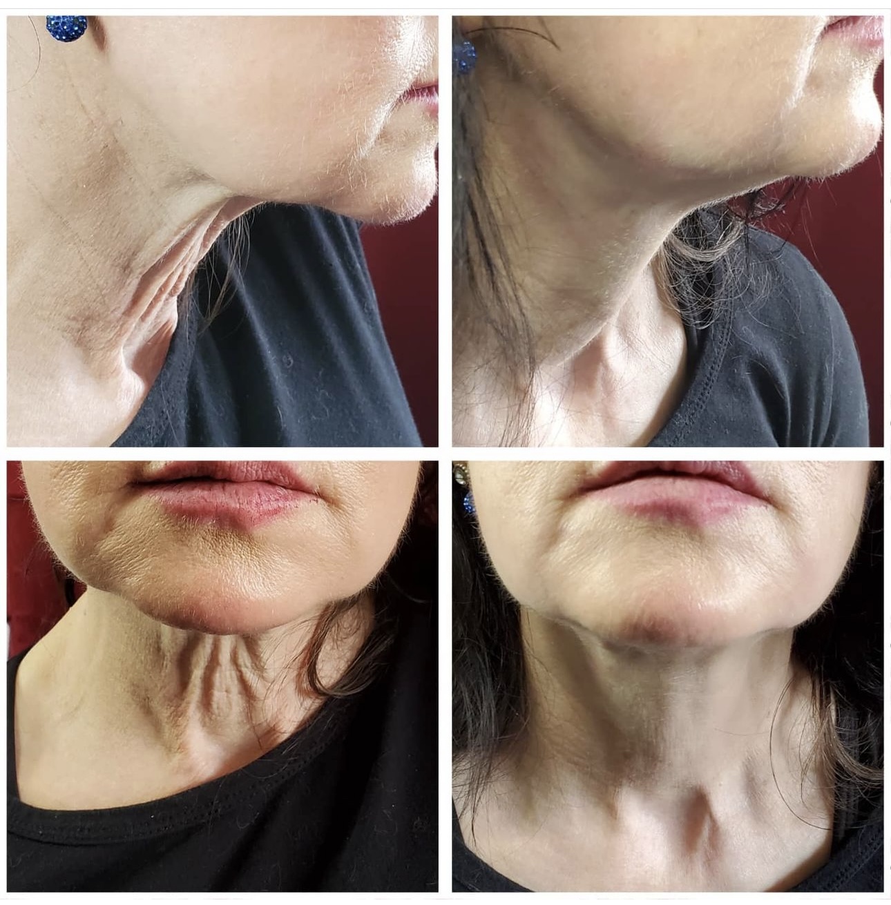 Before and after cosmetic treatment results